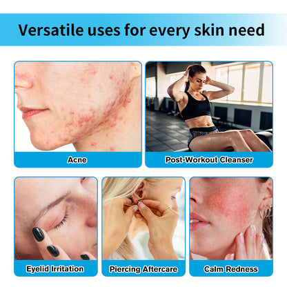 LAKERAIN Hypochlorous Acid Hydrating Facial Spray