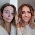Hannah McKenzie